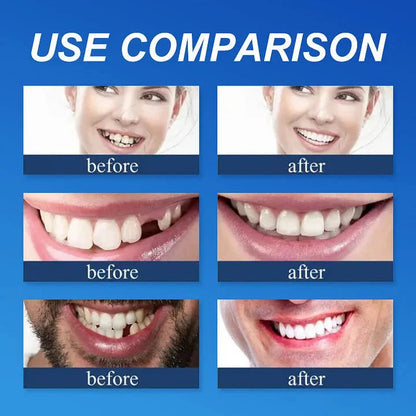 🌎Ends Today: 70% OFF! ⏰specialcoderes™ Medical Full Denture with Strong Suctiond🦷Obtain Dental Association Certification