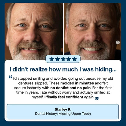 🌎Ends Today: 70% OFF! ⏰specialcoderes™ Medical Full Denture with Strong Suctiond🦷Obtain Dental Association Certification